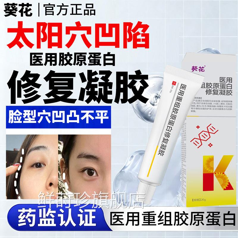白丰太阳穴面部凹陷填充神器医用重组三型人源化胶原蛋修复凝胶L