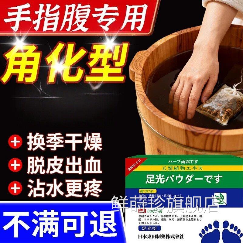 烛光粉手藓泡手用泡脚包真菌感染外泡皮肤去湿症脱皮干裂正品鲜莳