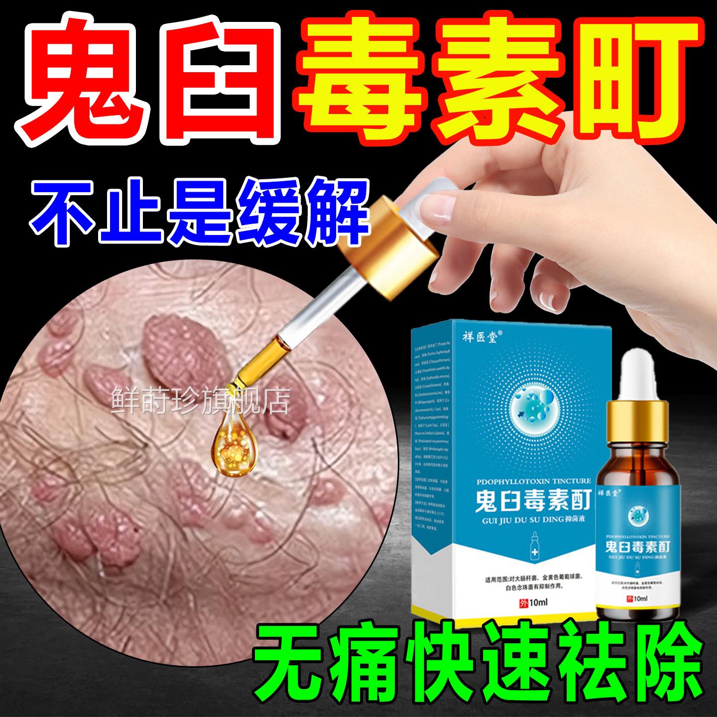 鬼臼毒素酊软膏皮肤清洁抑菌液外用尖锐湿扁官平尤犹方正品旗舰店