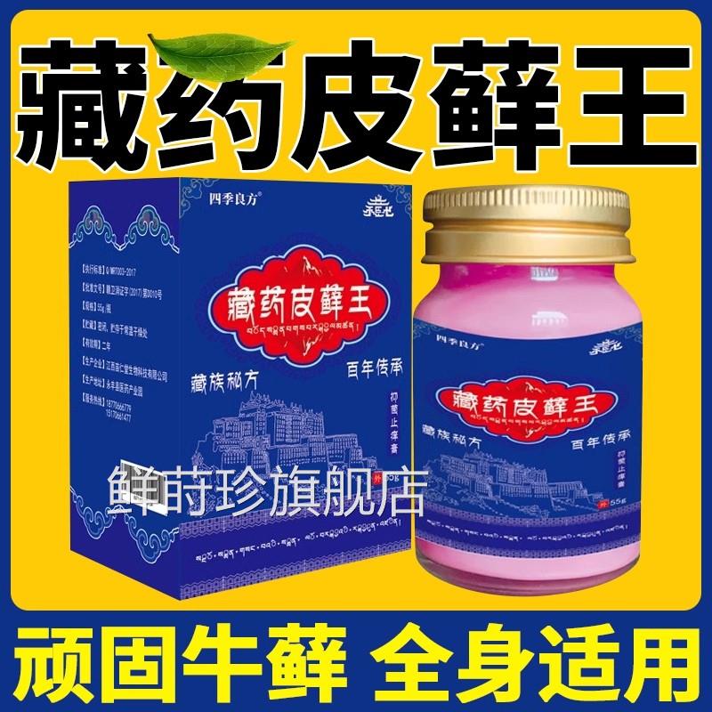 藏族皮藓王牛皮药膏头皮股银去杀屑病皮肤菌症止痒抑菌正品专用癣