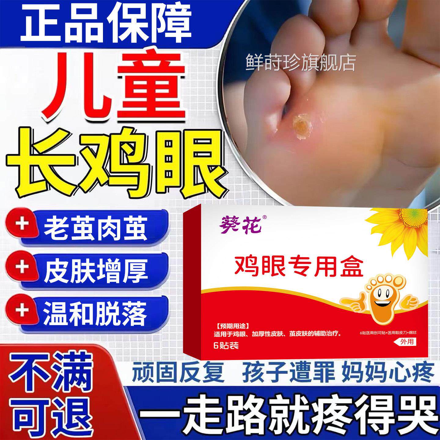 葵花儿童医用鸡眼贴尤净去角鸡质治疗鸡眼根膏除鸡眼根贴去专用鲜