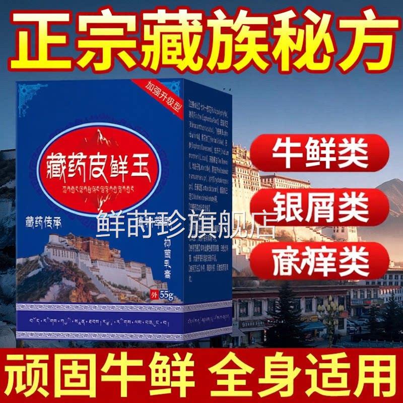 藏药皮藓王牛皮药膏股头皮银去屑病皮肤菌症止抑菌正品用鲜莳珍旗