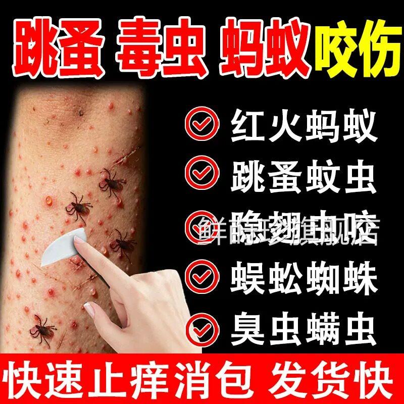 跳蚤止痒咬膏红肿用蚂蚁咬伤膏消肿蚊虫叮咬成人儿童正品官方鲜莳