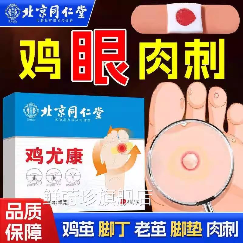 北京同仁堂鸡眼贴膏鸡尤康去除老茧手足部趾底肉刺老茧官方脚正品