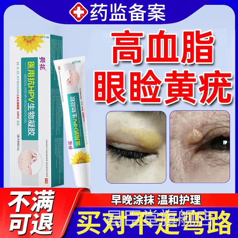 眼睑黄瘤去眼皮黄斑瘤黄疣专用膏部脂肪粒睑眼黄疣眼角黄斑去除UU