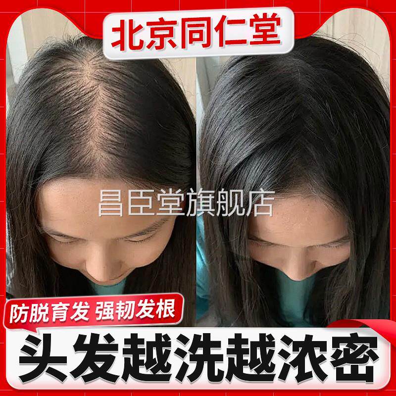北生京同仁堂姜防脱洗发水生发中药增发密发去屑育发排行榜名昌臣