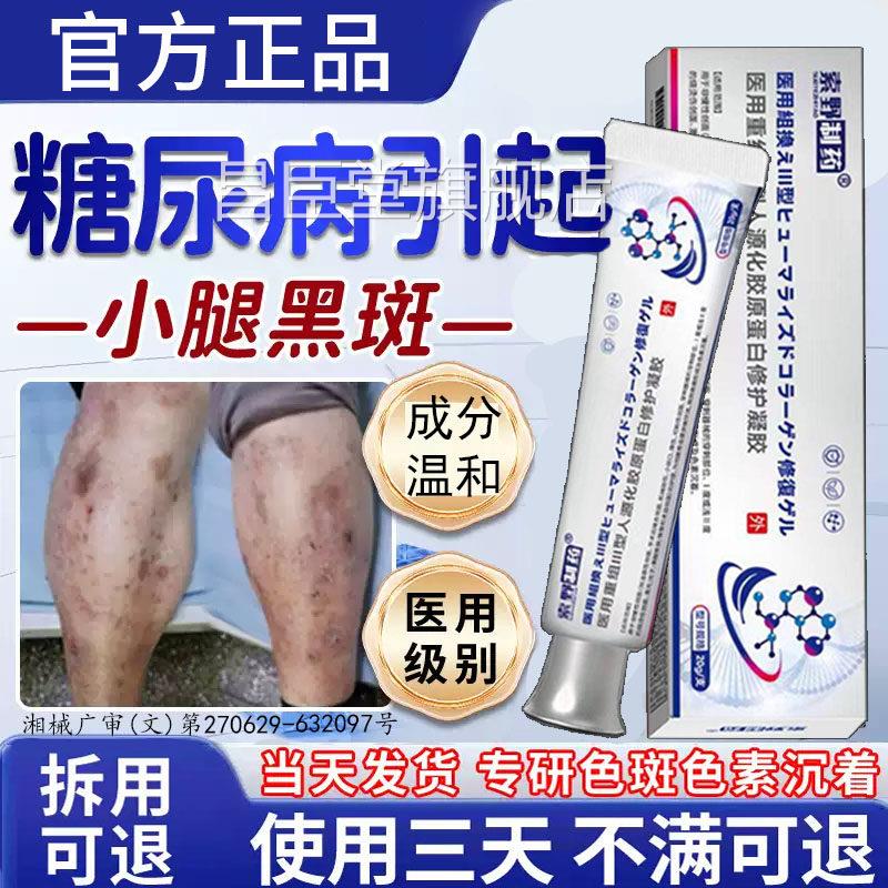 糖高小腿胫前黑斑糖尿病疤痕印去除糖斑专用皮肤痒药房血同售膏BD