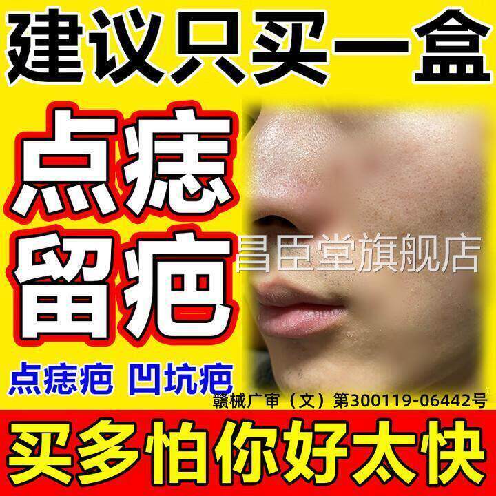 点痣后去疤痕修复膏祛疤膏红印去黑印生色素沉淀增点斑用修复液昌