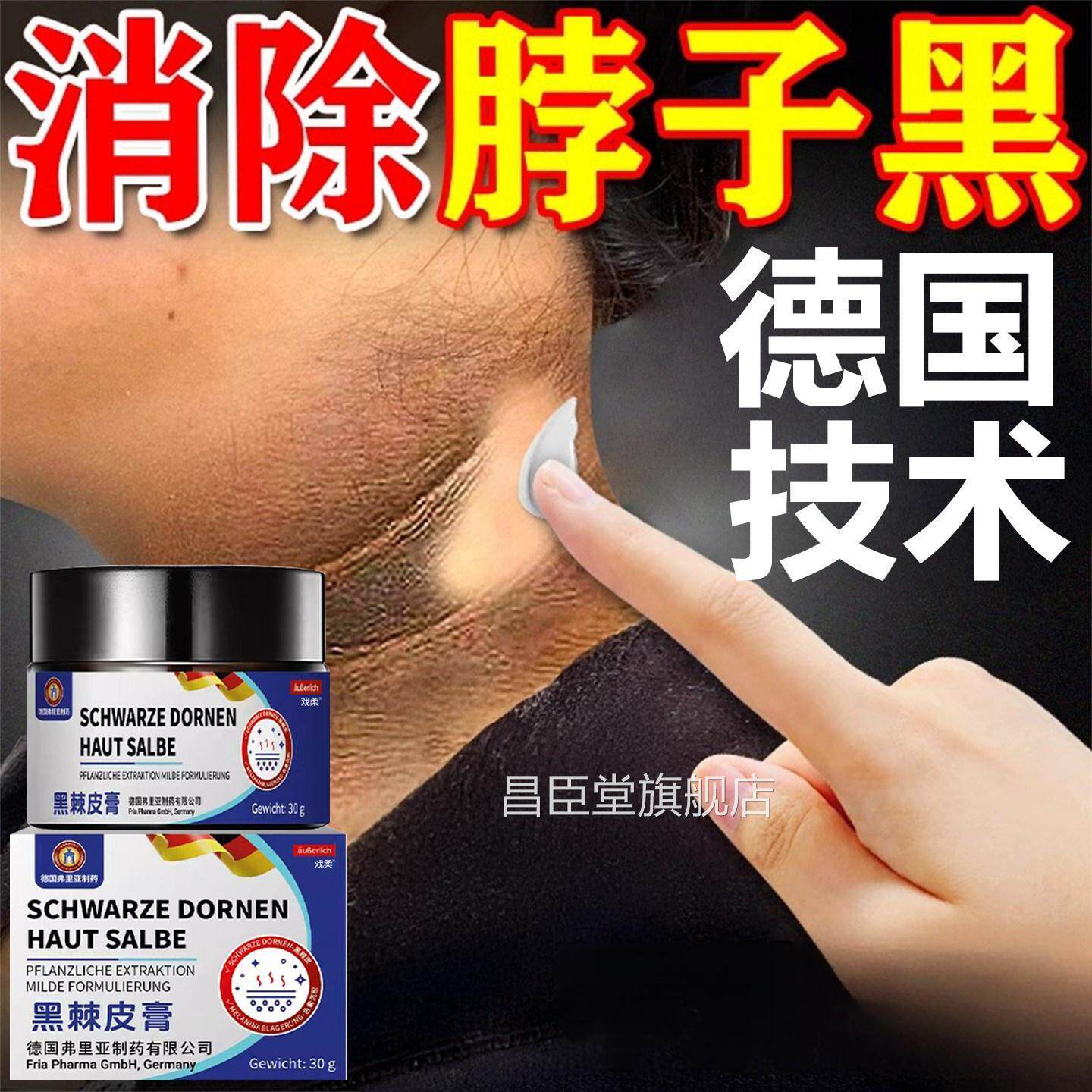 去黑脖子黑色色素去除沉淀症黑棘皮膏颈神器黑素儿童成人皮肤正品