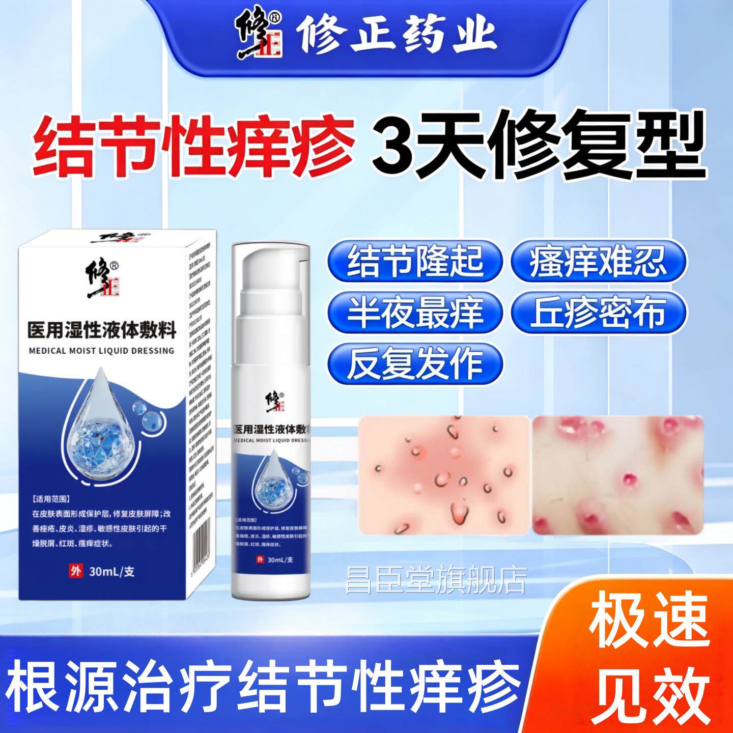 结节性痒疹特顽固效硬疙瘩皮肤真菌染湿疹止瘙痒膏专用抑菌感膏昌