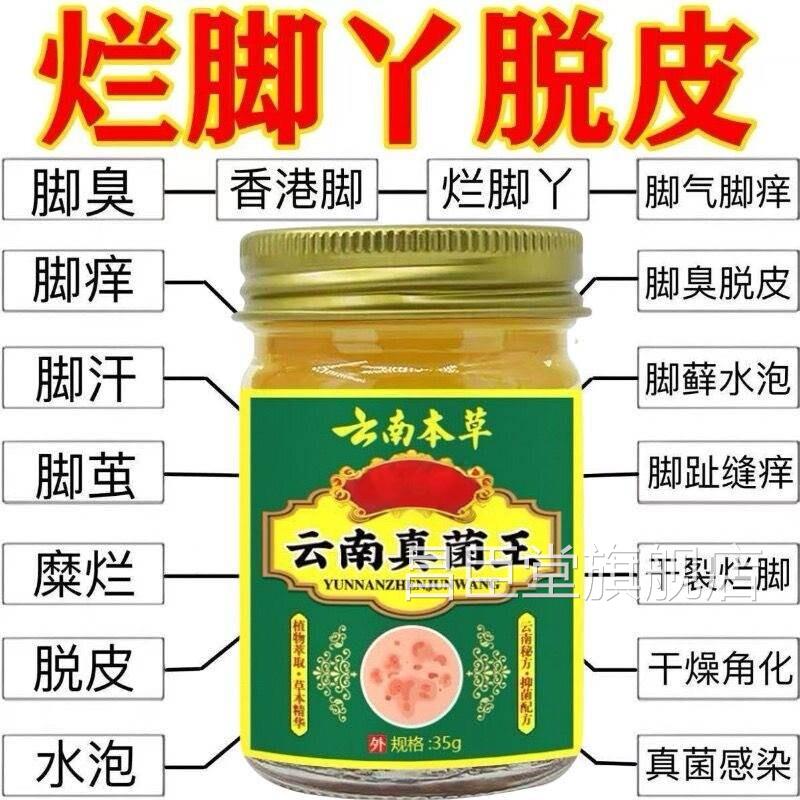 云南真菌王脚气烂脚丫脚痒脚臭脱脚皮起水泡真菌感染抑菌止痒正品