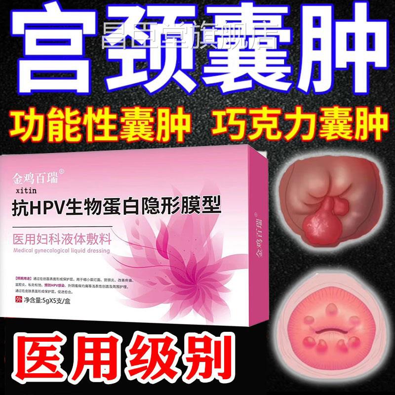 宫颈肥大纳囊肿药治疗宫颈囊氏肿糜烂息肉修复子宫内膜白带异常GX
