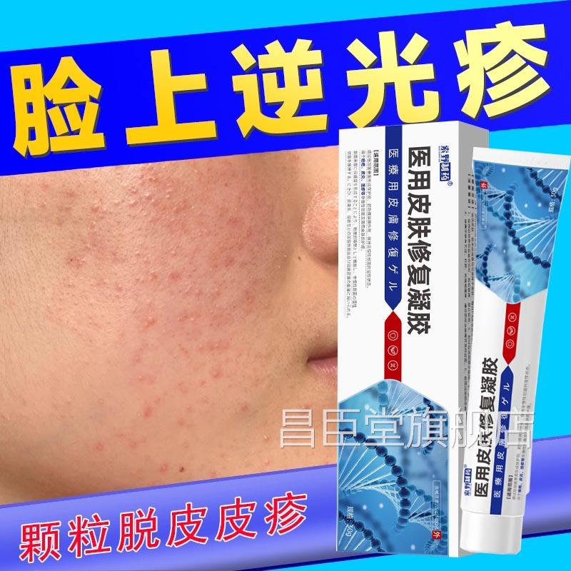 脸上额头上起小疙瘩小颗屏障修复逆光疹去除脸部闭口粉刺R粒S昌臣