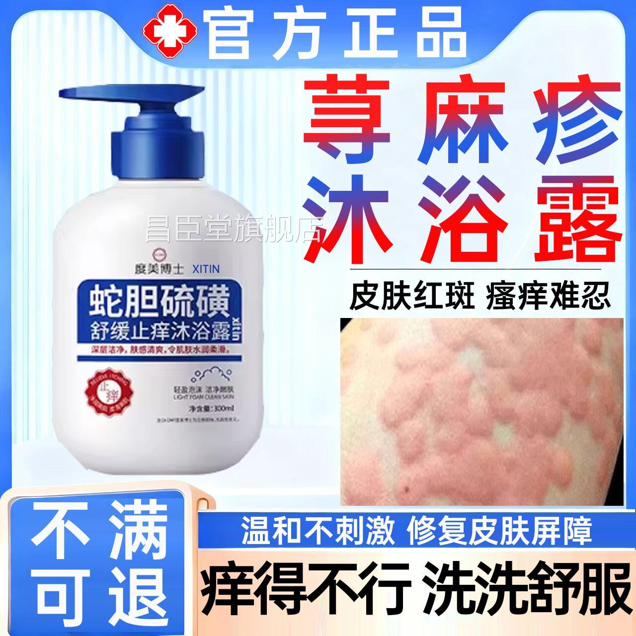寻荨麻疹沐浴露专用香皂肥皂儿童过敏止痒修复皮肤中断药房同售UU