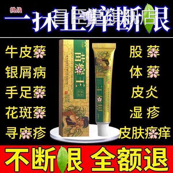 苗藓王药膏头皮股银藓藓藓屑病皮肤杀菌牛专用止痒官方正品官方昌