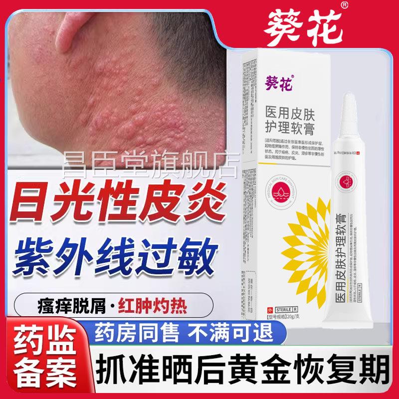 日光性皮炎紫外线敏太阳过晒伤皮肤专用修覆霜瘙发痒药房同款膏SS