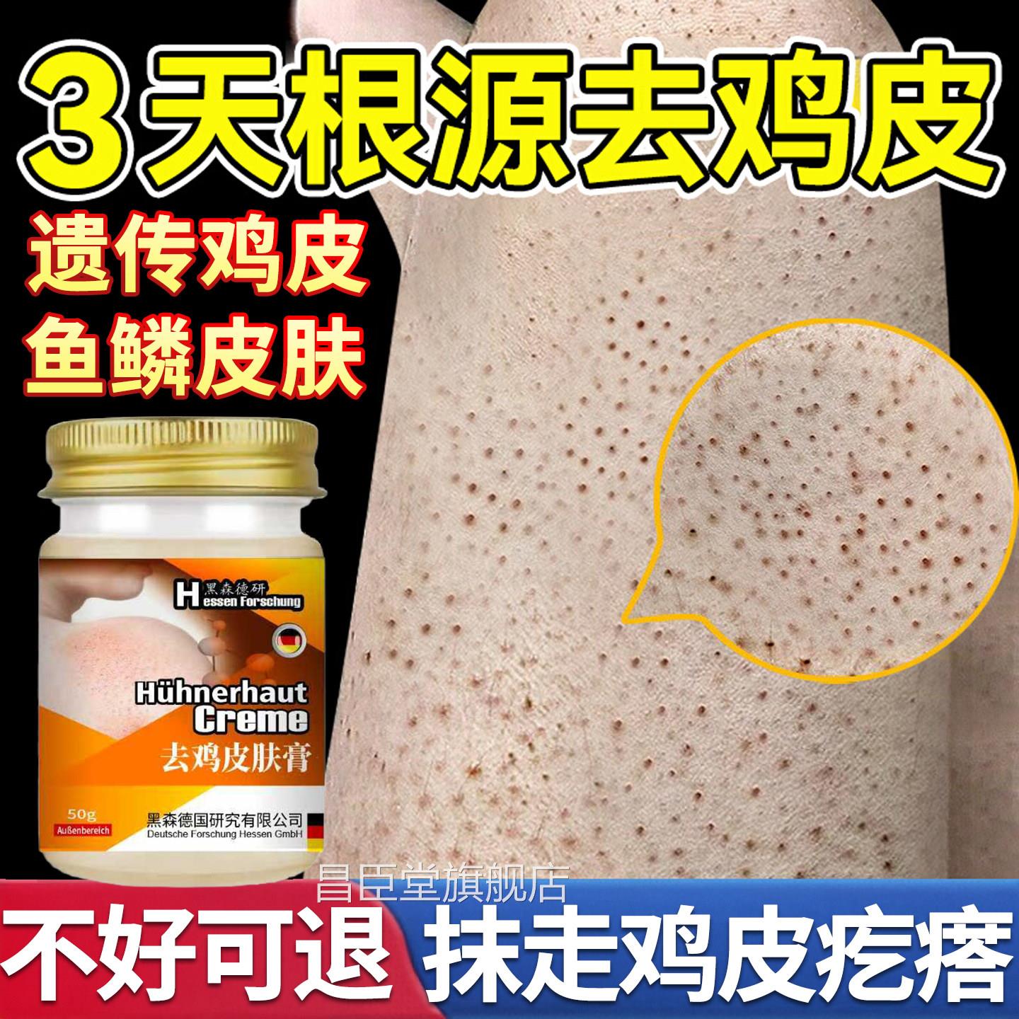 日本鸡皮肤疙干瘩毛囊角化症专用膏去除全身手臂胳膊腿燥起皮神器