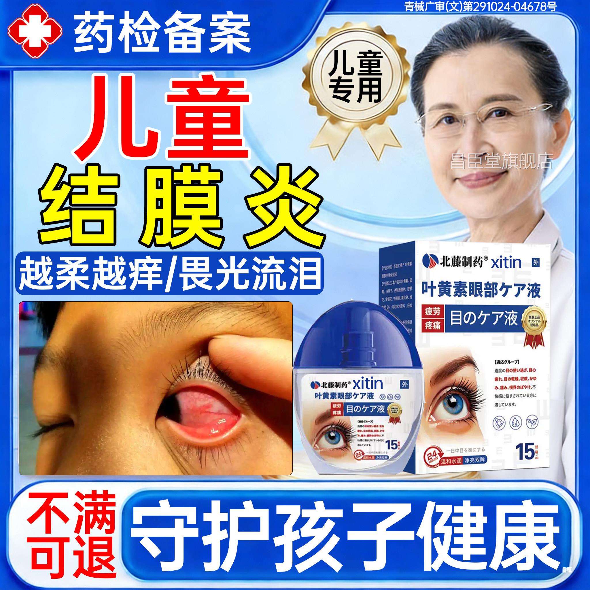 儿童过敏性结膜炎滴眼液专用眼水眼皮红肿眼睛周围发痒畏光痒PP昌