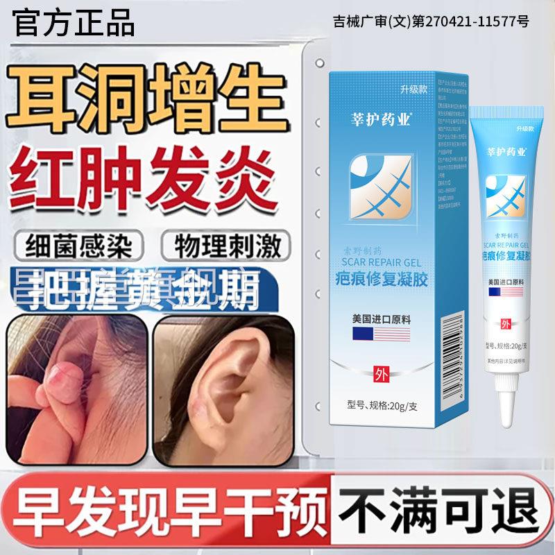 耳洞增生疤痕疙瘩凸起硬肉软化针可搭膏药贴去止软化痒乳膏BD昌臣