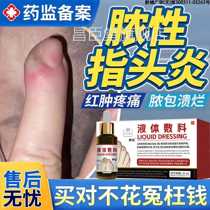 脓性指头炎手指化脓指甲真菌手感染药监备案甲沟炎消肿化脓BD昌臣