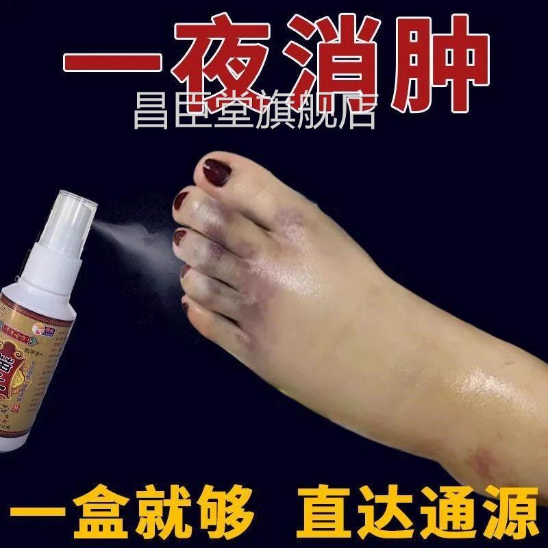 去水肿消特效的药老人脚肿消肿的药肿止痛喷剂活血化瘀消外用专用