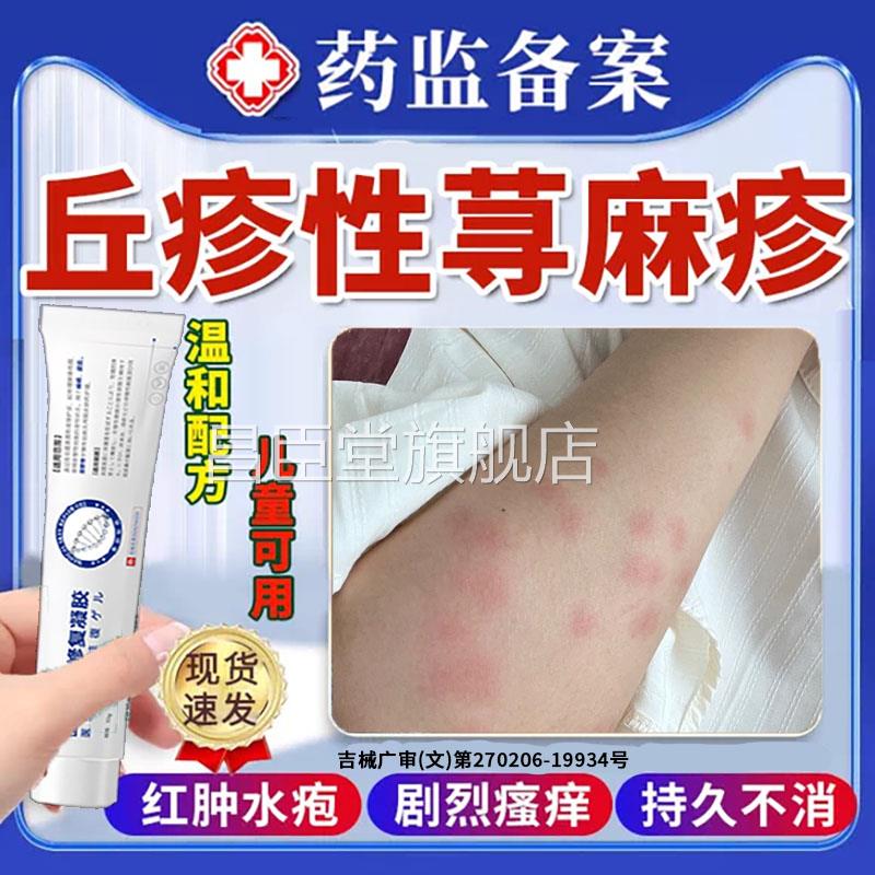 丘疹性荨麻疹虫咬性皮炎皮增强免疫力寻肤过敏止痒药房同款膏BD昌