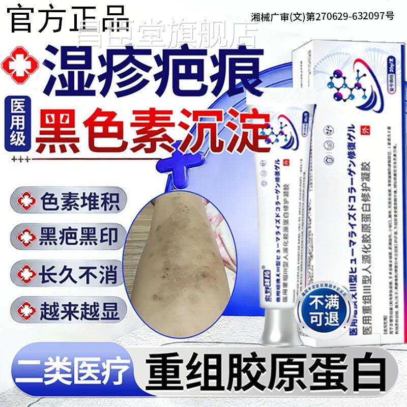 湿疹去疤去黑色素沉淀淡化疤痕祛疤膏祛除黑印印色素沉淀药膏BD昌