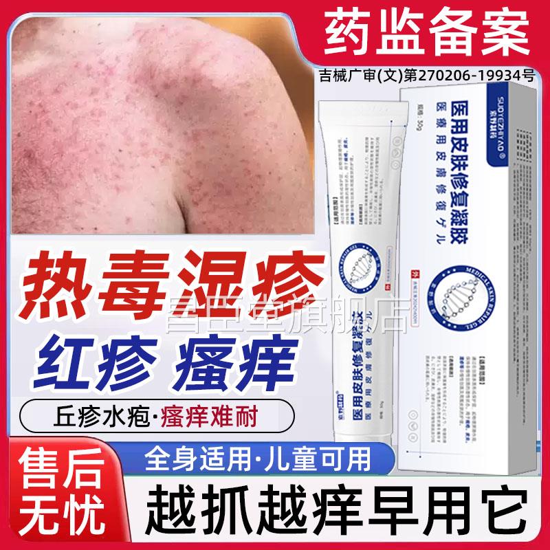 热毒湿疹止痒膏皮肤瘙痒皮炎一就痒血热热性抗菌消炎身上长红斑QQ