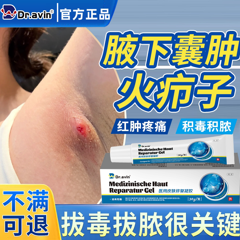 腋下粉瘤皮脂腺囊肿专火疖子拔毒拔脓包硬块用疖肿毛囊炎膏药贴CS
