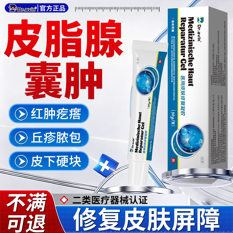 粉瘤皮下皮脂腺囊肿疖肿专用火疖子拔毒拔脓脓包硬块膏药贴去除CS