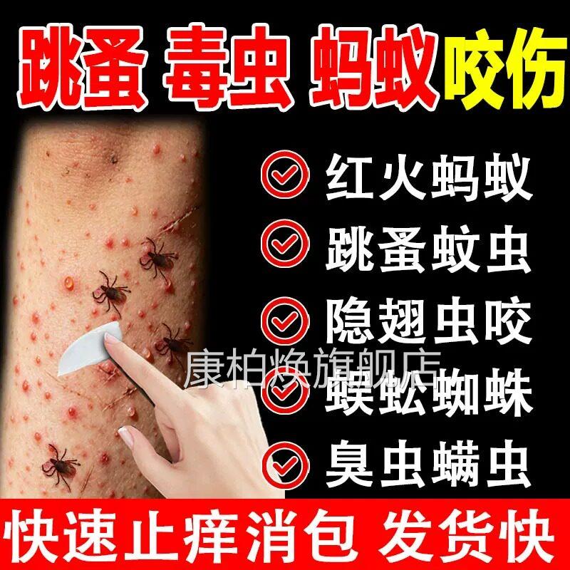 跳蚤咬止痒红肿用蚂蚁咬伤膏消肿膏蚊虫叮咬成人儿童正品官方康柏