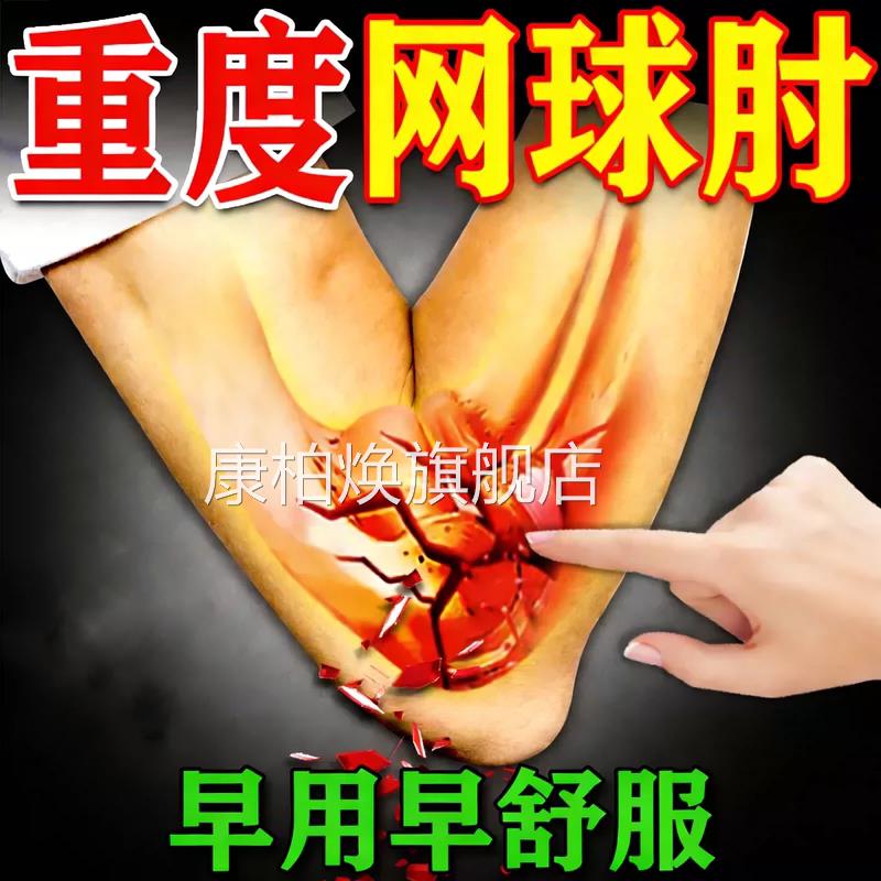 手臂筋膜疼手关节胳膊疼痛滑膜炎专用肌肉拉伤劳损复搭修膏贴康柏