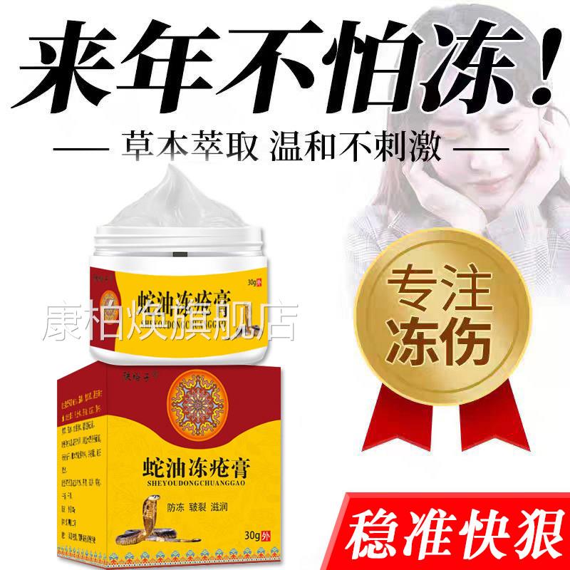 冻疮专用膏痒治冻伤膏冬季冻手脚儿童脸部耳朵防冻神器止正品官方