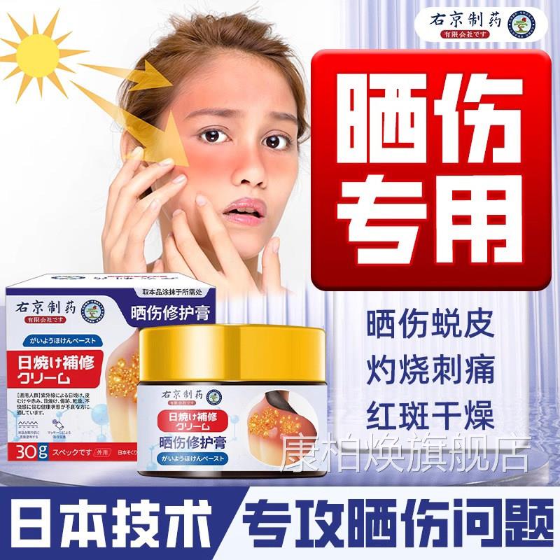 日本皮肤晒伤修复学生晒后外膏泛红紫线脱皮脸部脖子正品旗舰店康