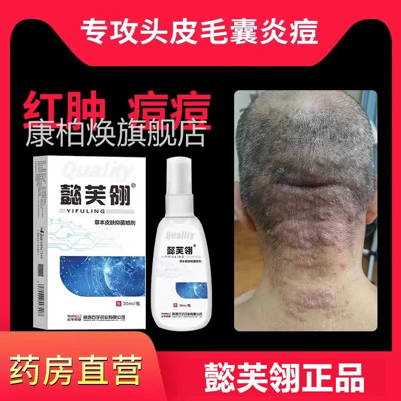 懿芙翎康光3号菌三号喷剂马拉色1丹马色拉菌毛囊炎喷雾头皮专用WY