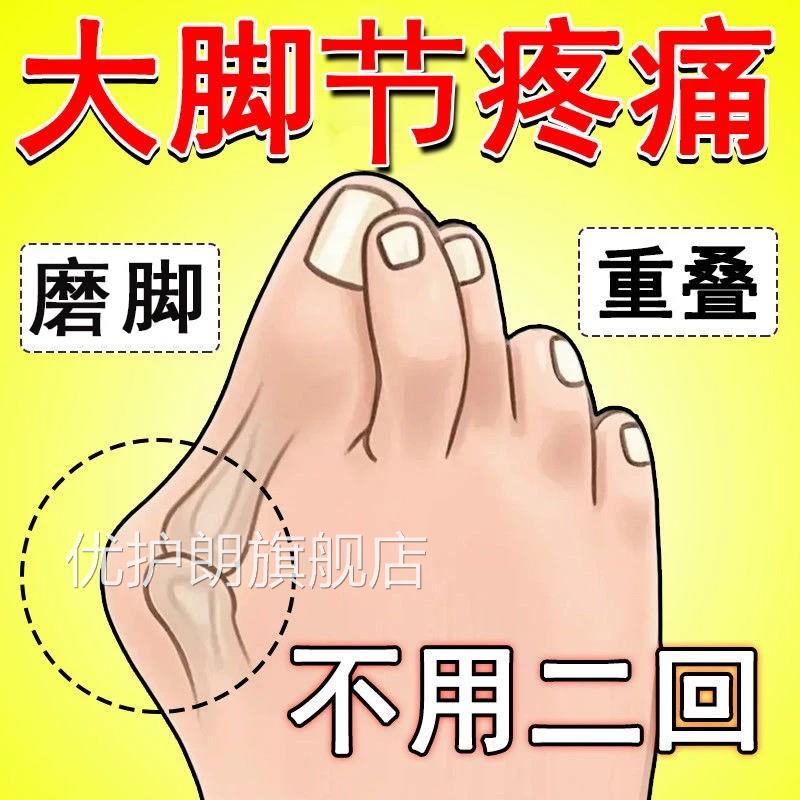 拇【已愈100w人】指外翻膏药贴专用大脚趾骨外翻突出矫正器拇囊炎