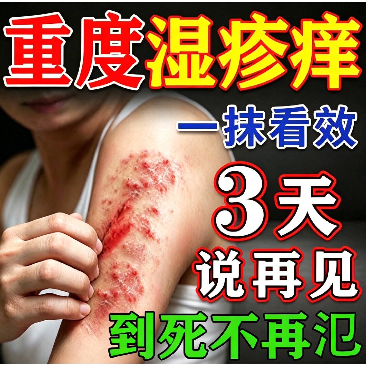 疹湿止痒根外去用顽固皮炎效特膏药皮肤瘙痒专用除湿舒缓干痒旗舰