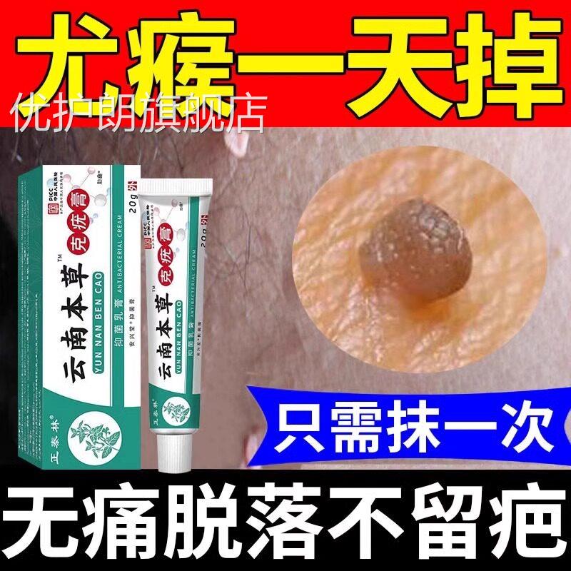 云南本草克疣膏疣药水尤脖瘊子小肉粒扁平疣去除软膏去一抹灵神器