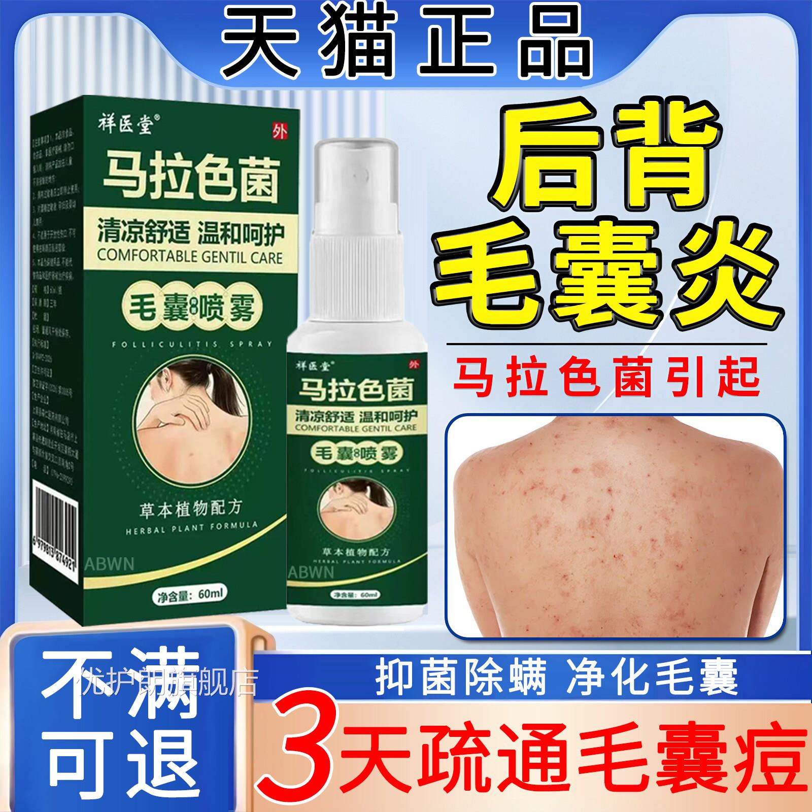 后背毛囊炎去除背上痘痘除螨祛痘前胸痤抑疮专医用特真菌效药喷剂