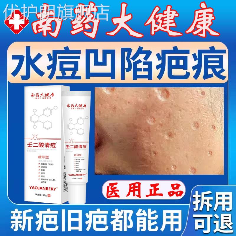 水痘疤痕修复去水痘坑痘坑凹洞修复生长因子凹陷性疤痕修复填充gx