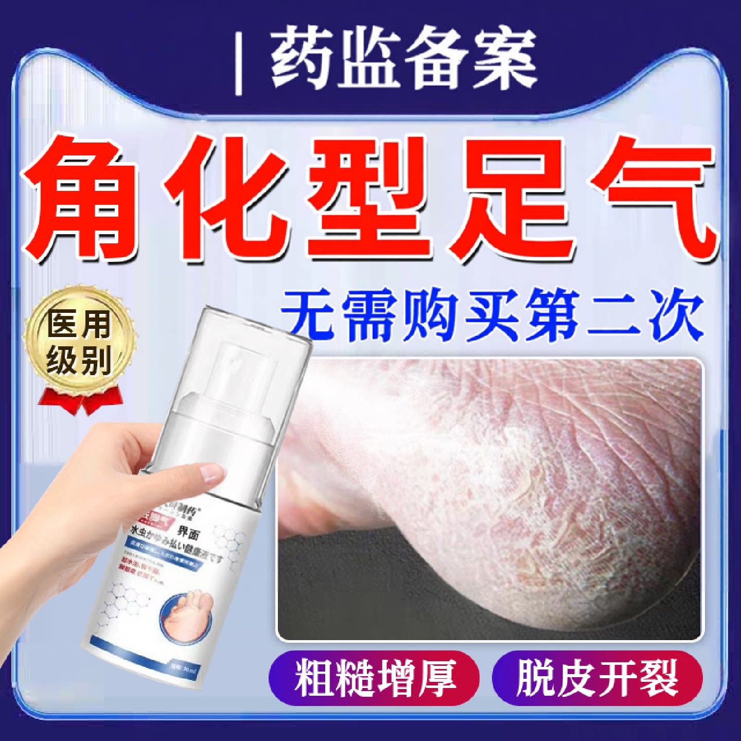 脚后跟干裂真感菌染鳞屑角化型足气开起硬皮足跟足癣一旗舰店