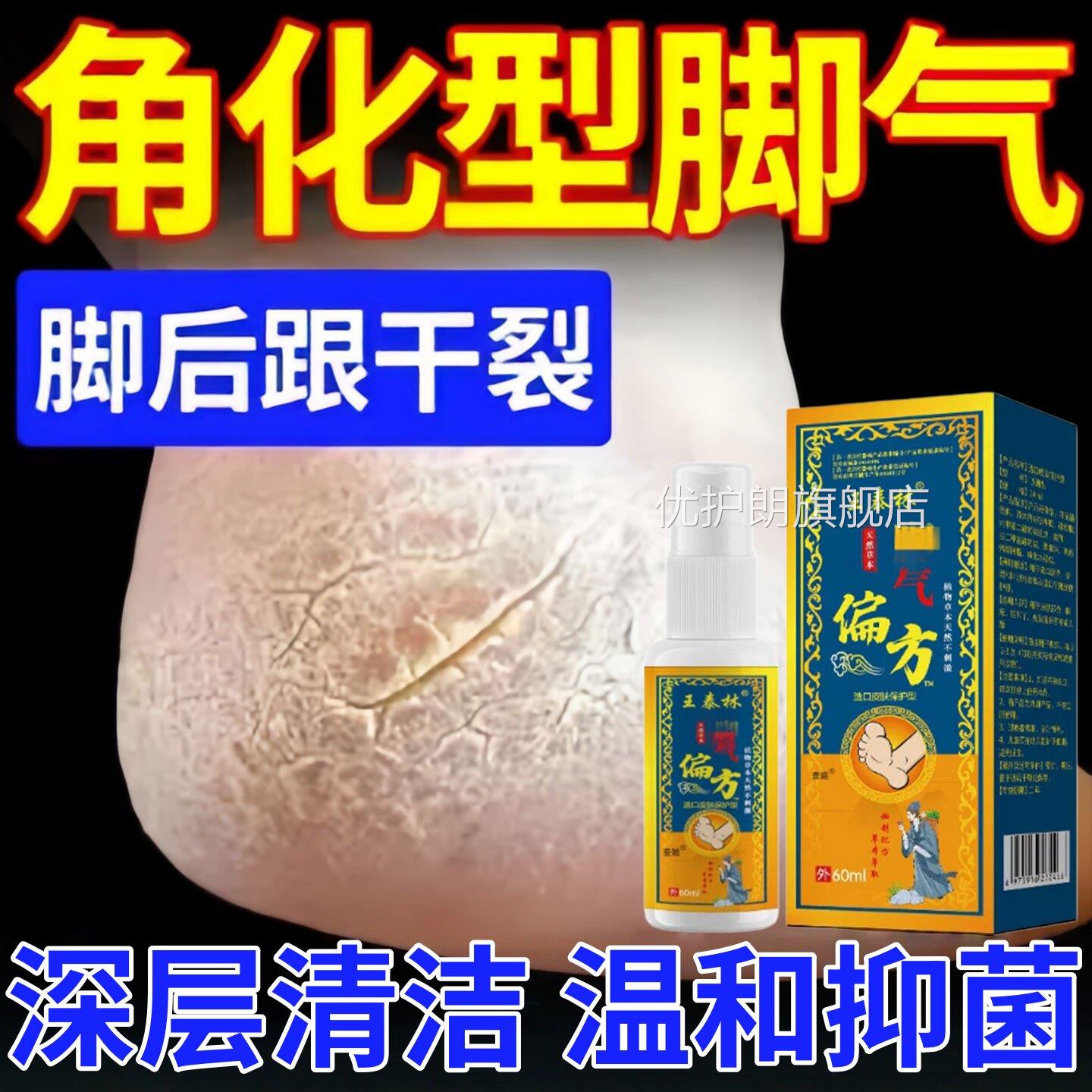 气脚偏方脚气脱皮真臭菌感染烂脚丫水泡脚喷雾抑菌喷剂专用正品优