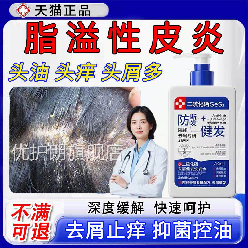 二硒硫化洗发水脂溢性皮炎毛囊炎去屑止痒抑菌头皮真菌感染头癣优