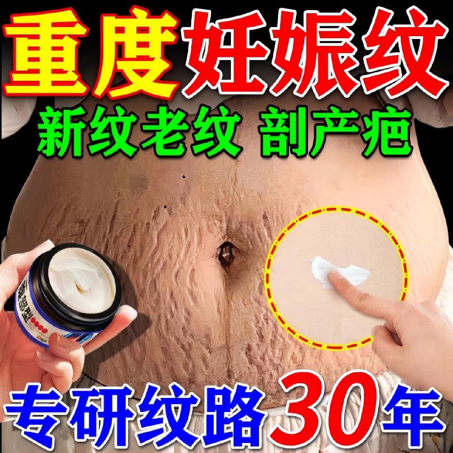 淡纹膏妊辰纹消除紧致肚皮松弛修复霜淡化遮盖瑕膏神器正品旗舰店
