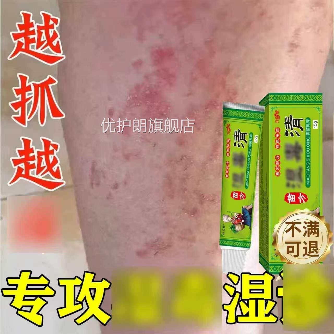 湿毒清抑菌软膏止痒皮肤专用药膏外用全身瘙痒旗舰正店官方品优护