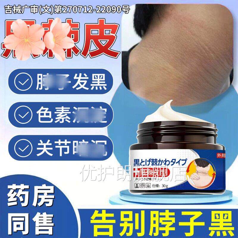 去脖子色素去除黑棘皮后脖子黑颈部黑色素沉淀肥胖黑洗不干净美白
