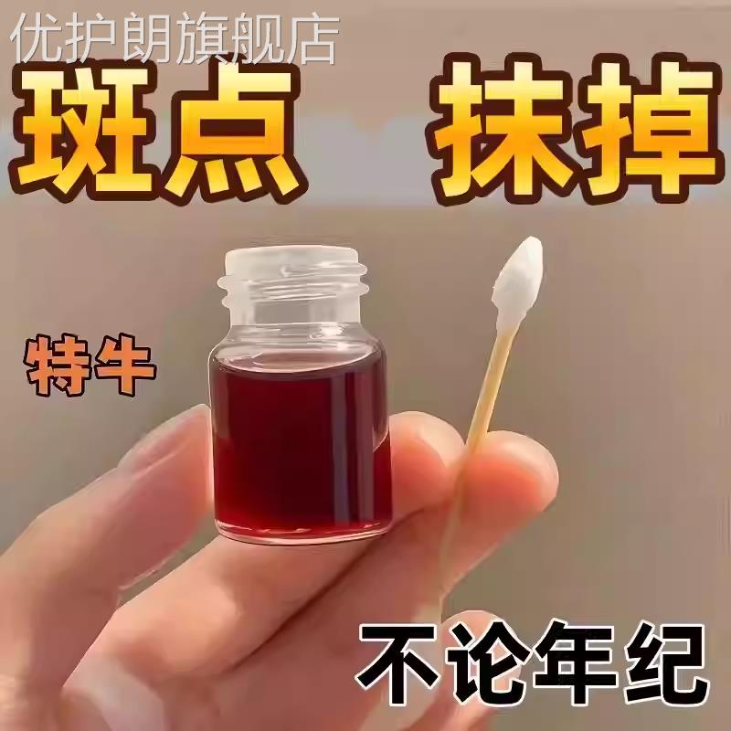 排斑液祛斑专治外用药水不留疤美容院去点斑雀斑膏官方正品旗舰店