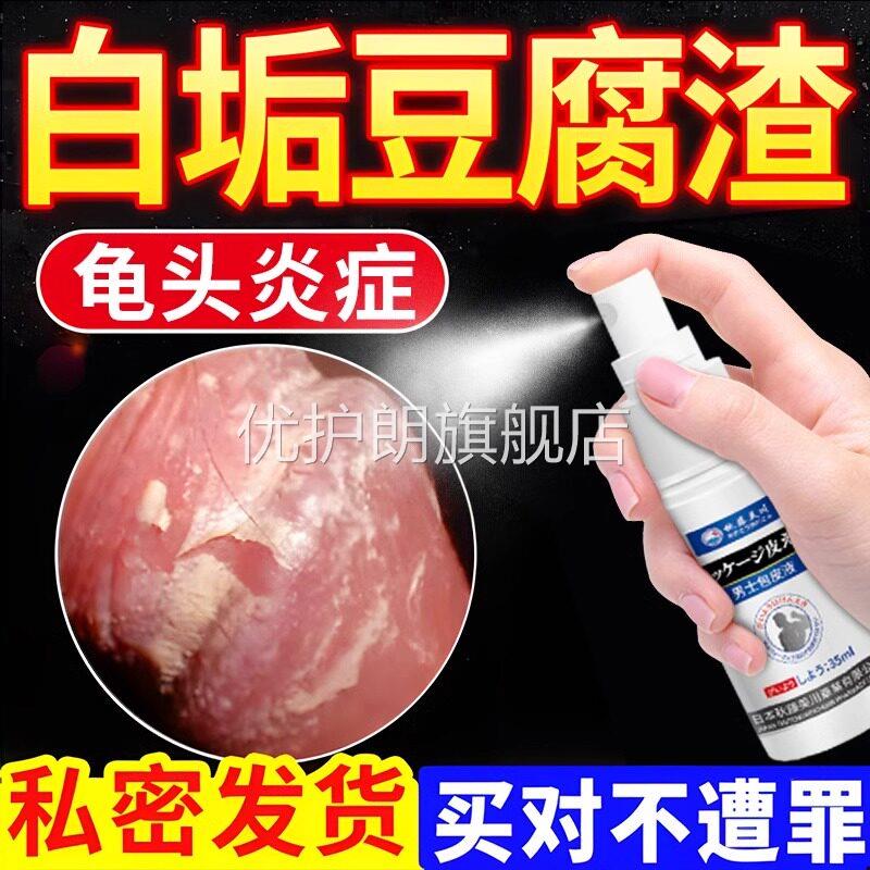 男性包皮炎私处真菌感染冠状沟肿裂白垢豆腐渣龟头红点龟头炎喷剂