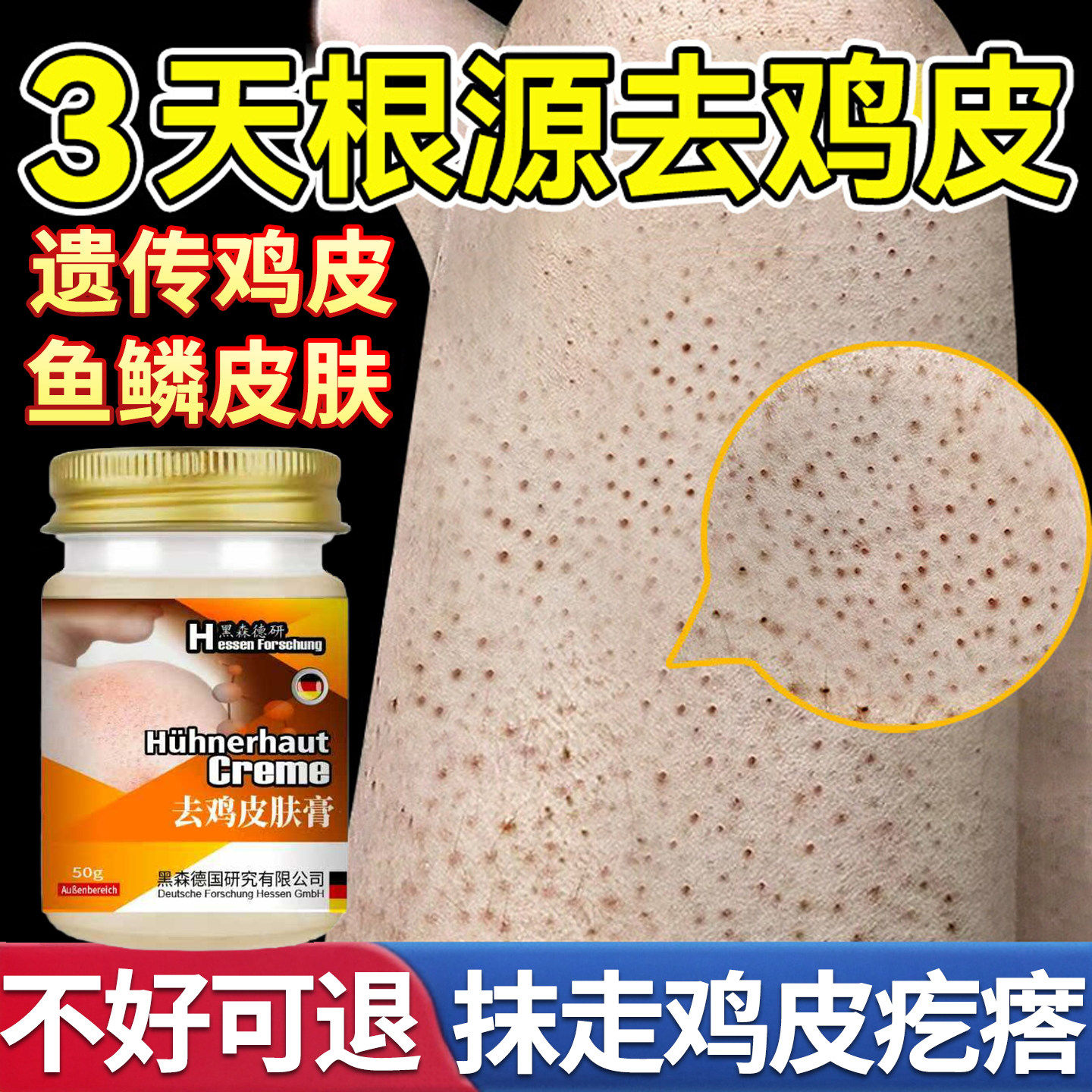 日本鸡皮肤疙瘩毛囊角化症专用膏去除全身手臂胳膊腿干燥起皮旗舰