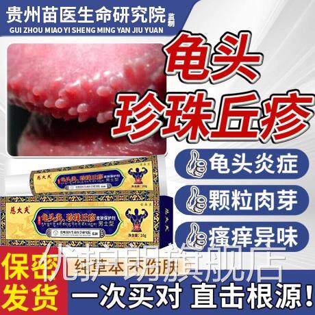 龟头炎症冠状沟珍珠疹去除龟头系带旁丘腺疹颗粒皮脂异位症膏FF优